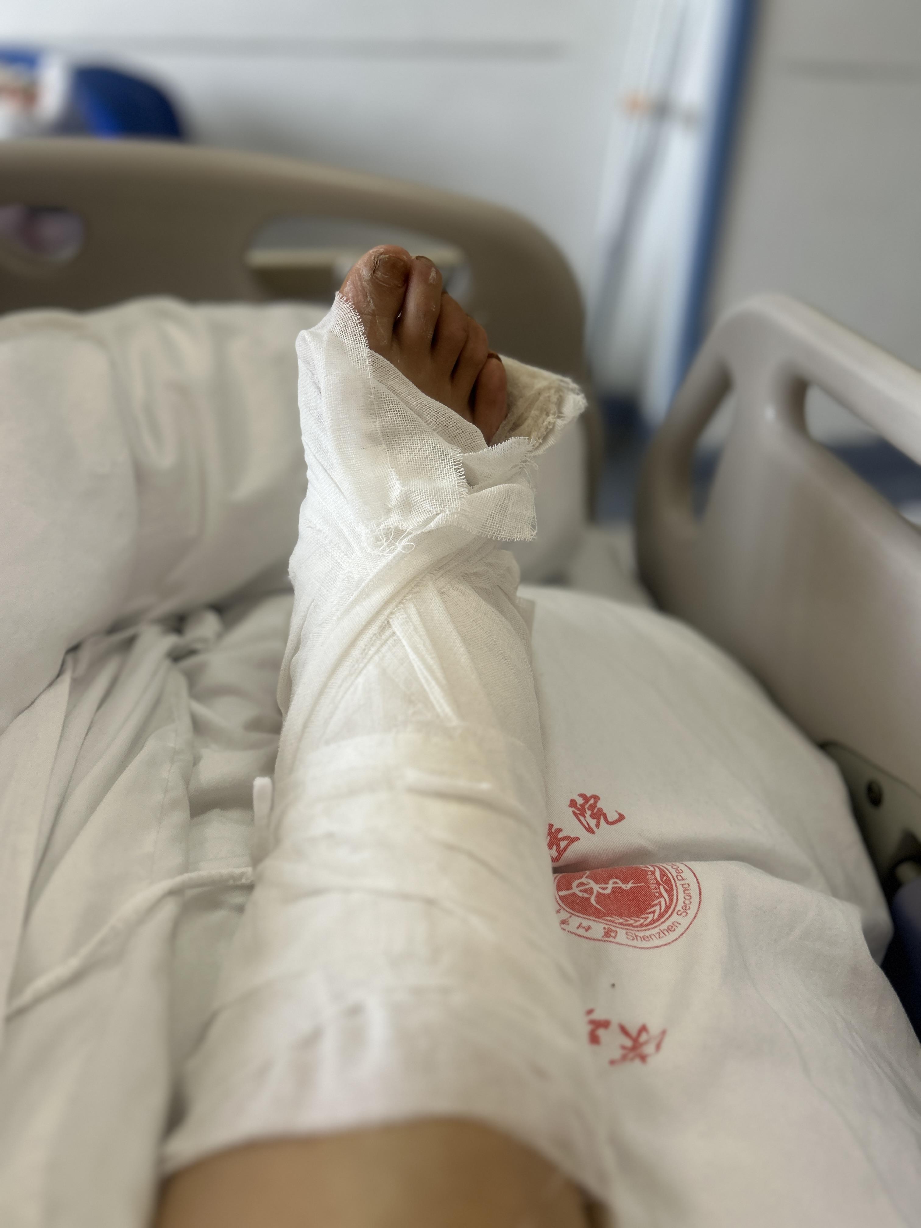 关于九游体育:归化球员费南多伤病康复训练方案与效果评估的信息 关于九游体育:归化球员费南多伤病康复训练方案与效果评估的信息